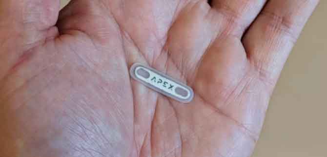 Implantable RFID Encrypted Wallet